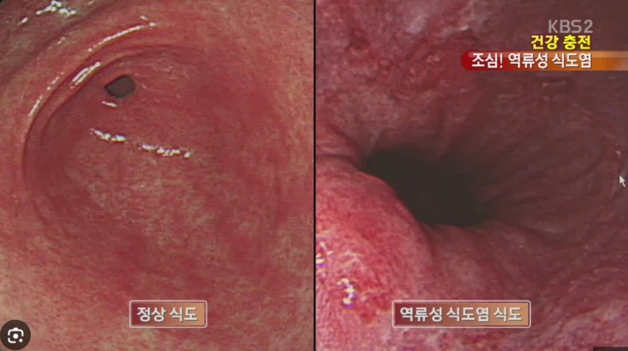 의외로 장애 질병_1.webp