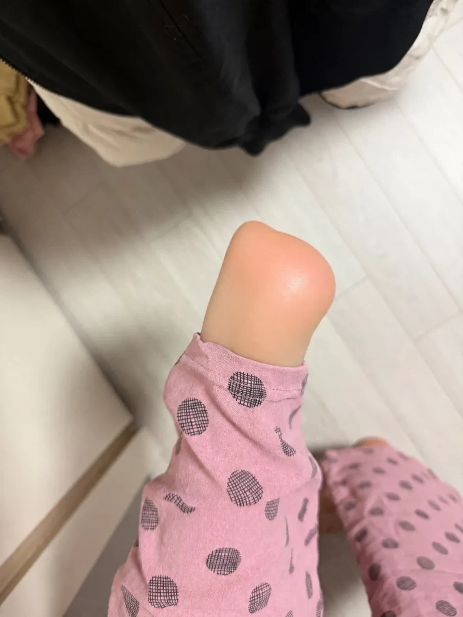 뒷꿈치 각질 없어짐_2.webp