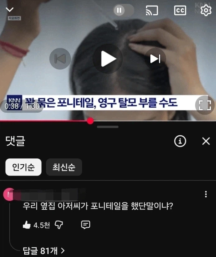 머리 꽉 묶은 포니테일, 탈모 불러 올 수도_1.webp