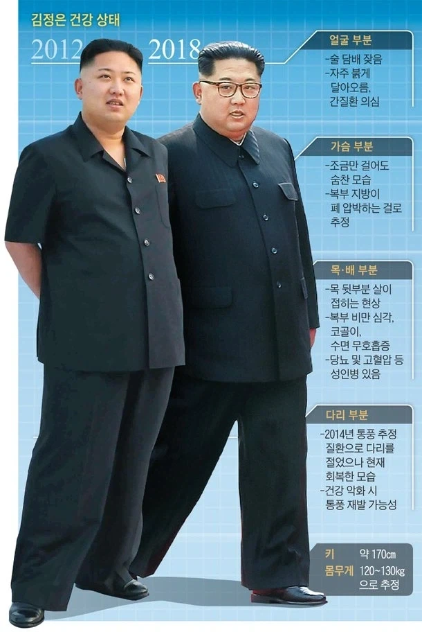 북한 김정은 비만인게 이해 안 되는 이유.jpg_1.webp