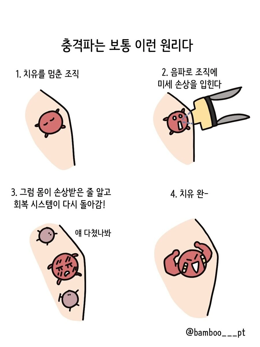 충격파 치료 받는 환자 유형.manwha_3.jpg