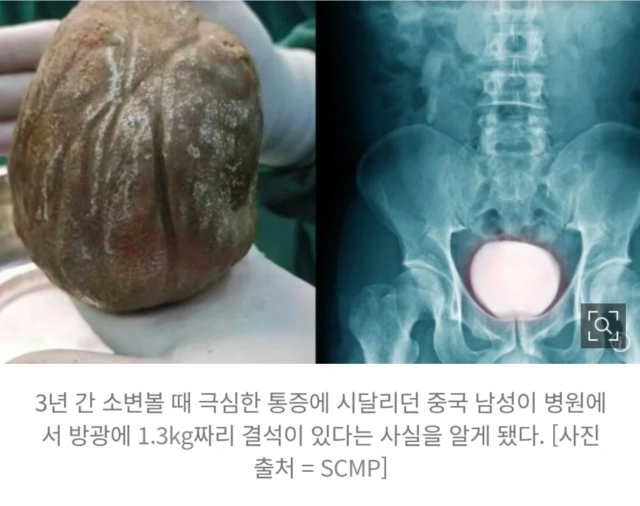 끄아악_2.webp