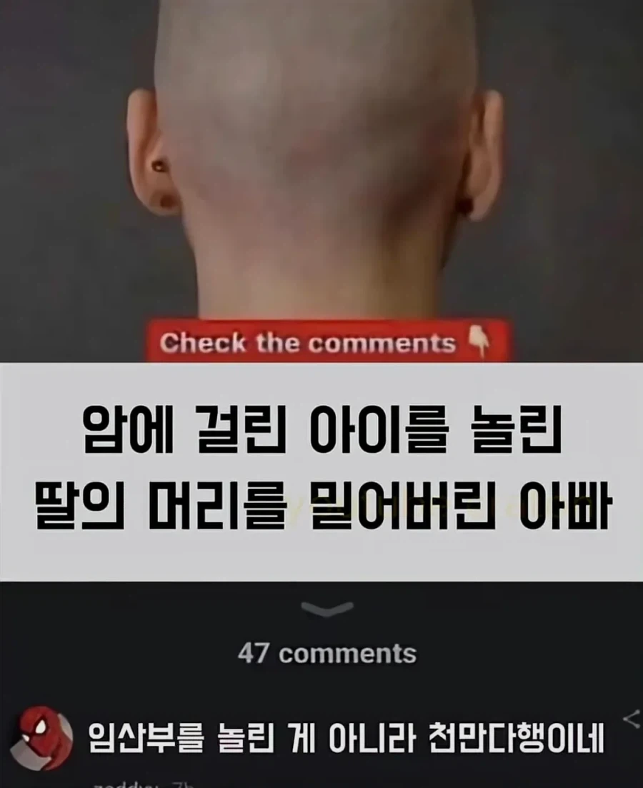 딸의 머리를 밀어버린 아빠.jpg_1.webp