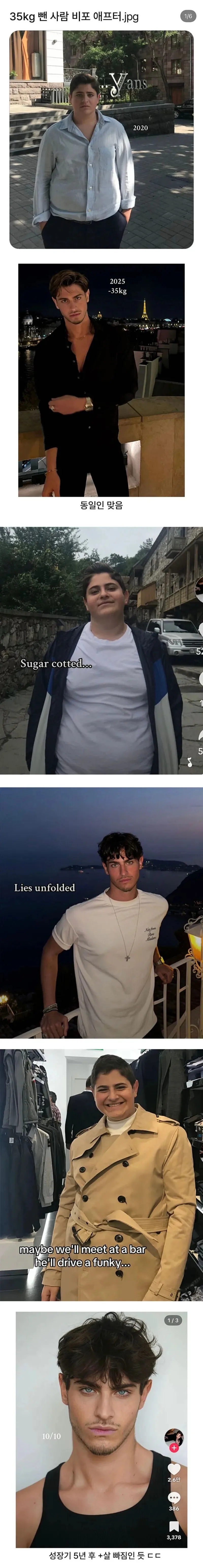 체중감량이 성형보다 압도적인 이유_1.jpg
