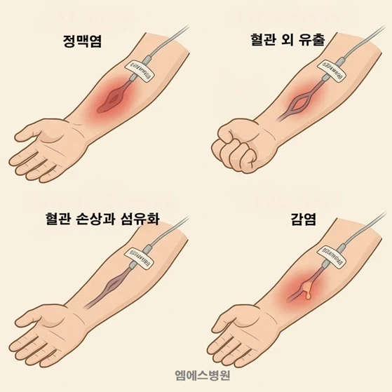 부작용 꽤나 크지만 그래도 사용하는 주사법_4.webp