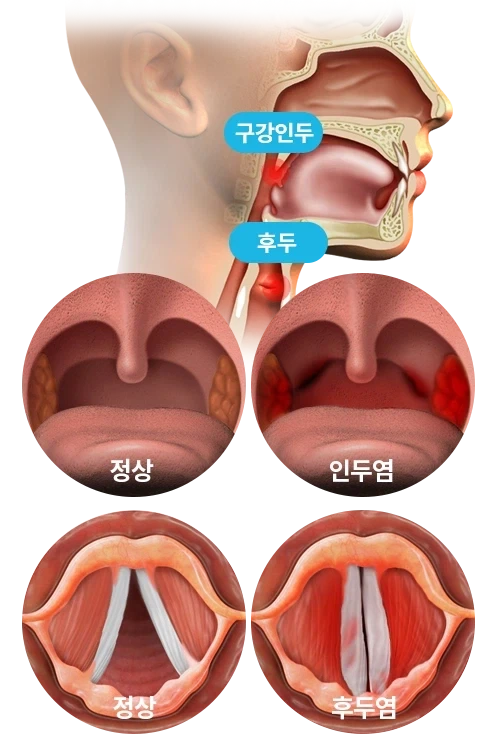 은근히 AV배우들이 달고산다는 질환_1.webp
