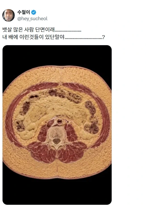 사람 지방에 불만인점_1.webp
