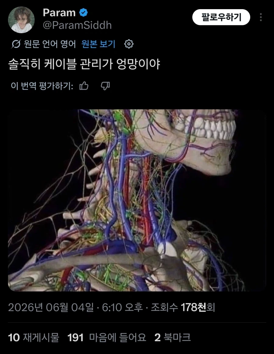 케이블 관리가 엉망이다_1.webp