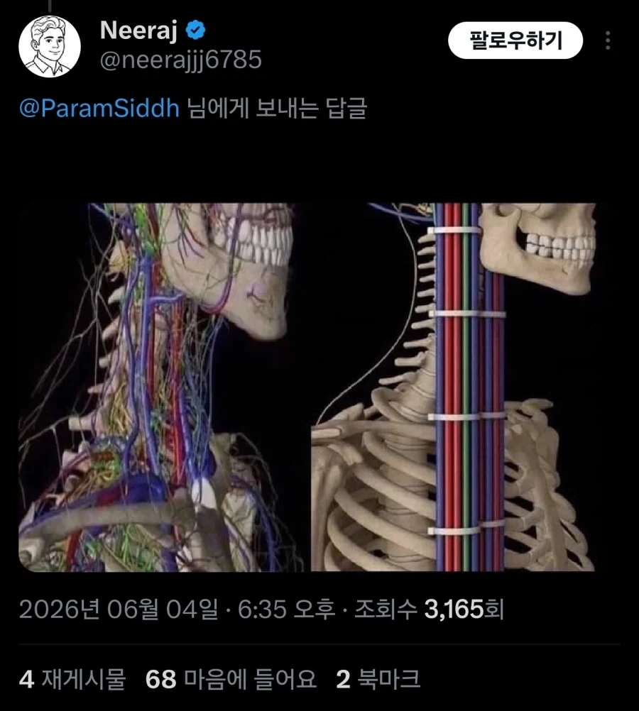 케이블 관리가 엉망이다_2.webp