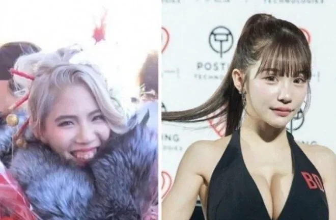 성형을 25번 했다는 여성 ㄷㄷ_1.webp