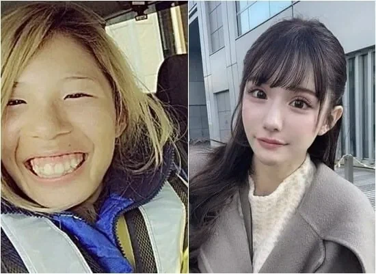 성형을 25번 했다는 여성 ㄷㄷ_2.webp