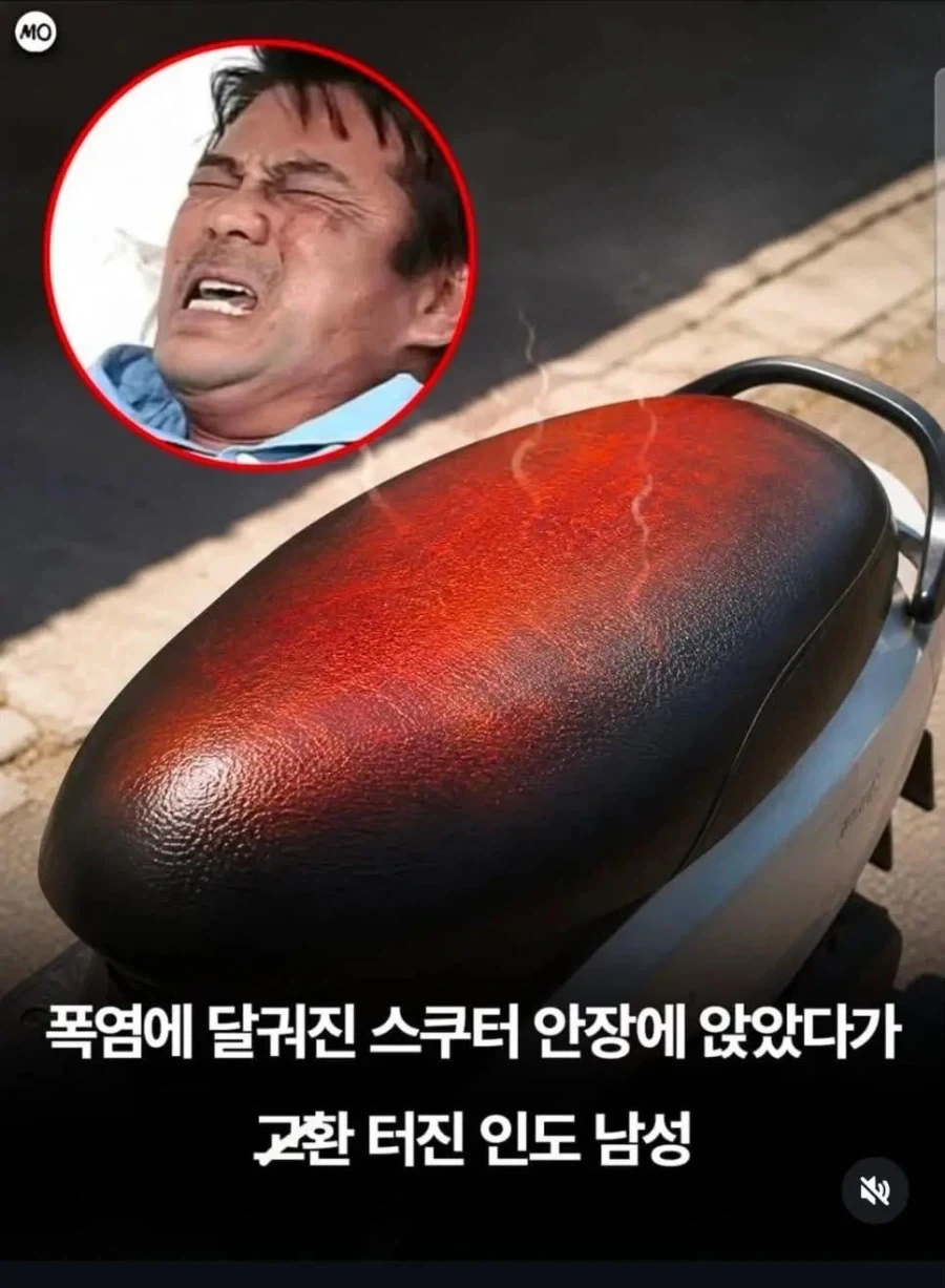 폭염에 스쿠터 안정에 앉았다가 고환이 터진 인도 남성_1.webp