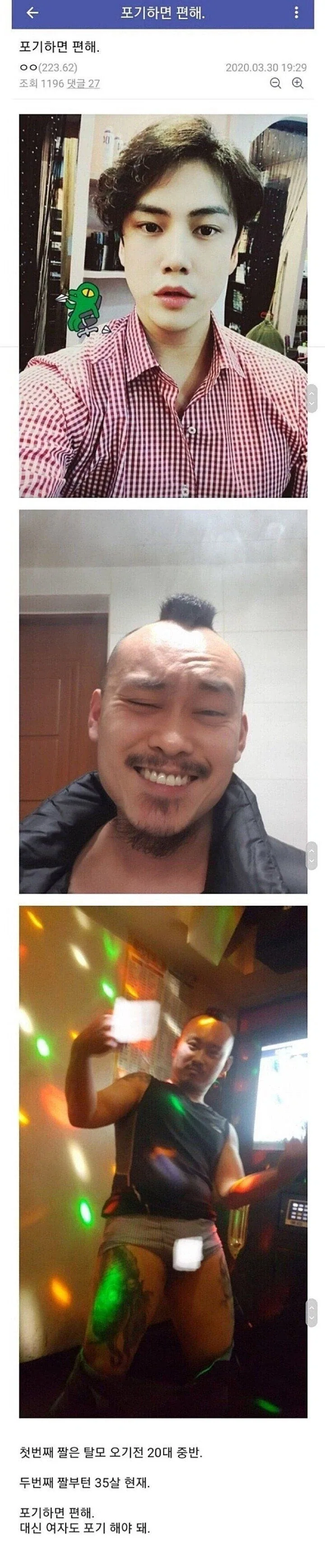 탈모는 포기하면 편하다_1.webp