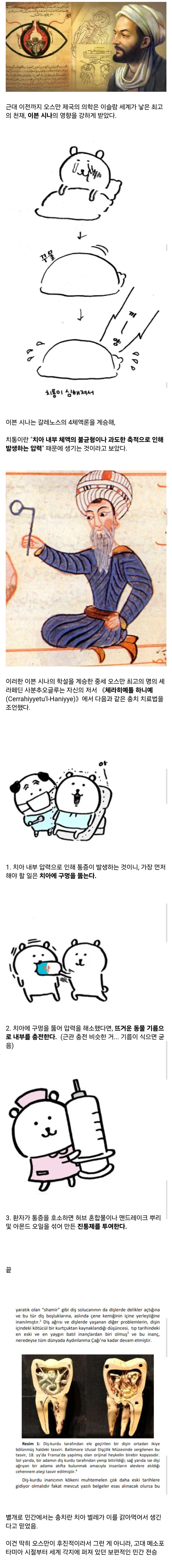 꽤 그럴듯했던 오스만 제국의 충치 치료법.jpg_1.webp