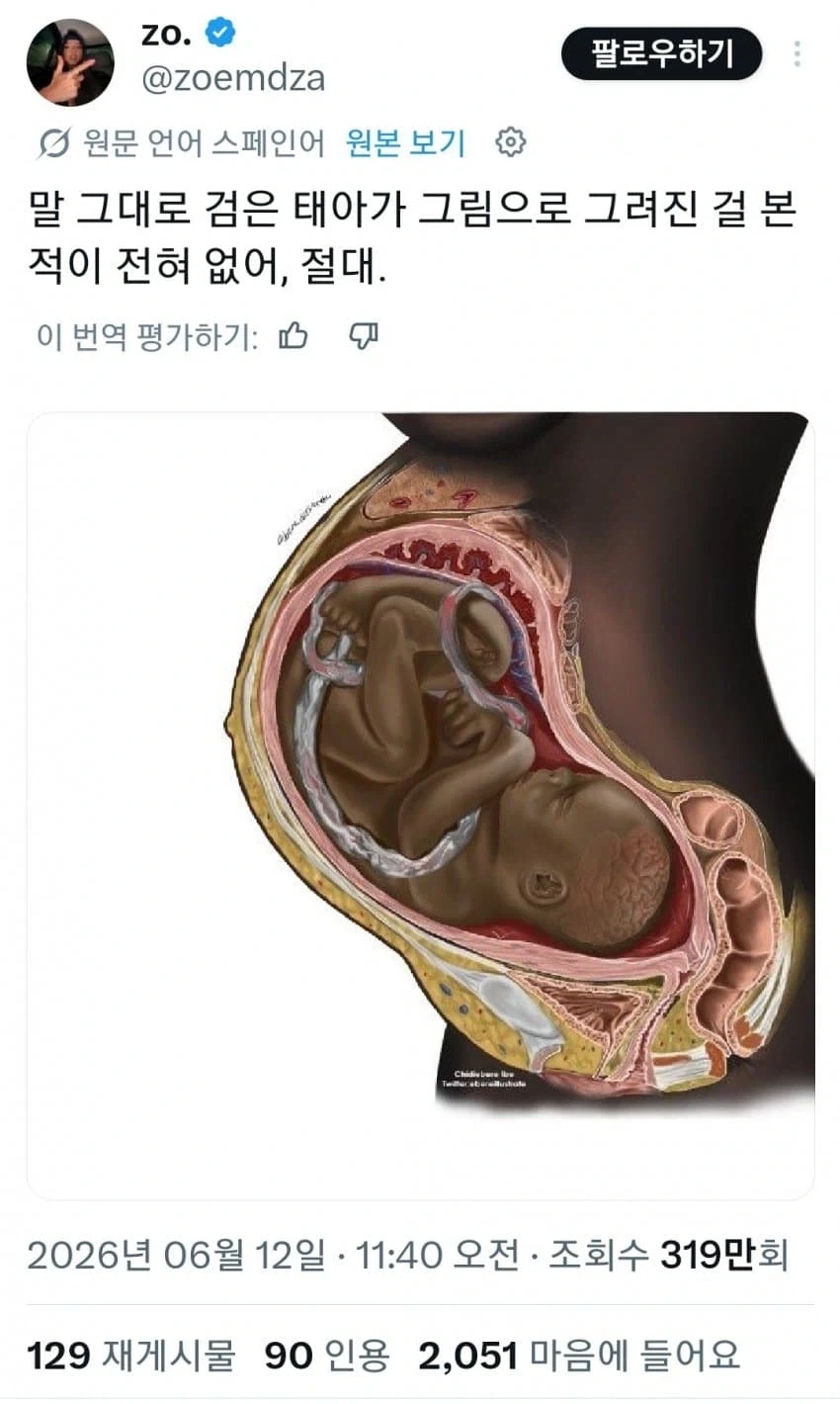 난 검은 태아를 본 적이 없어!!_1.webp
