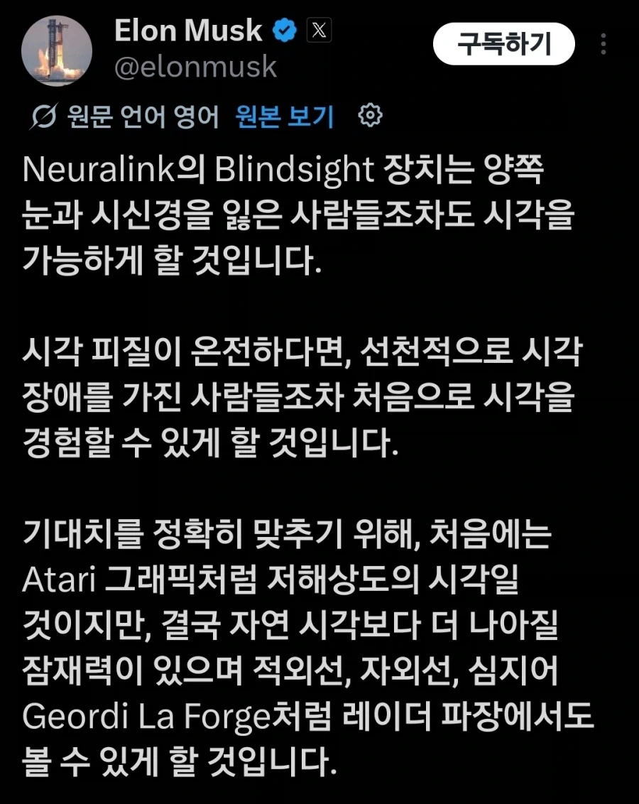 일론머스크의 시각 임플란트에 대한 포부.jpg_1.webp