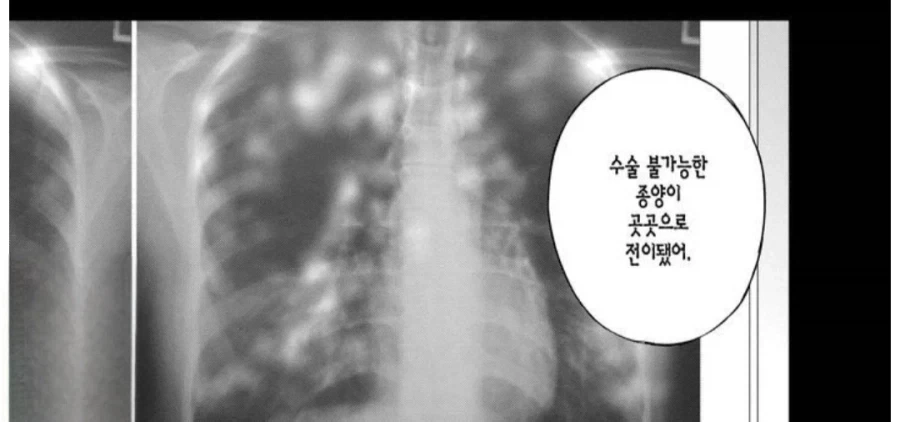 수술불가 암 말기_2.webp