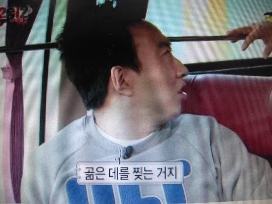 신경치료할때 마취해도 아픈 이유_5.webp