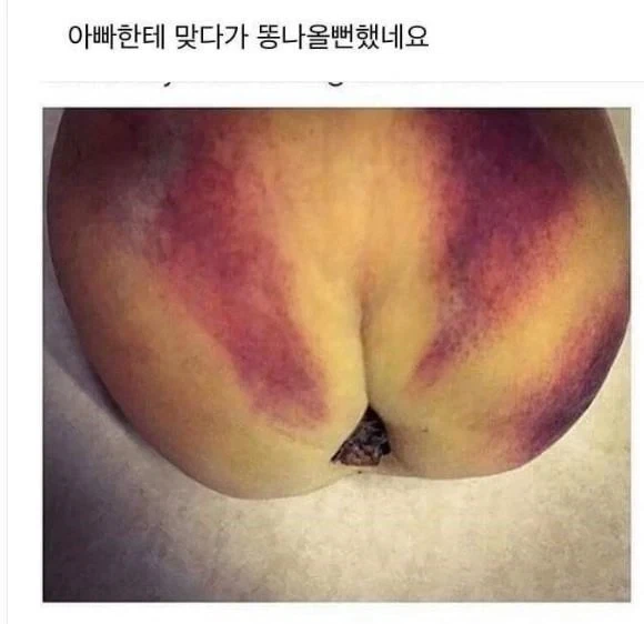 아빠한테 맞다가 똥쌀뻔 함_1.webp