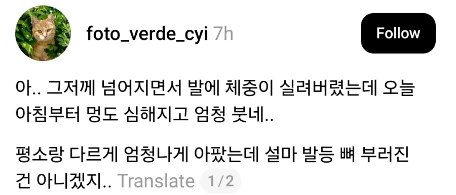 그저께 넘어졌는데 발이 엄청 붓네....jpg_1.webp