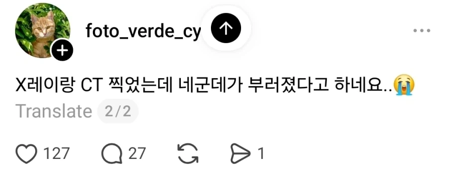 그저께 넘어졌는데 발이 엄청 붓네....jpg_4.webp