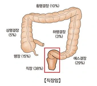 미국 워싱턴에서 수간죄를 만든 사건_3.webp