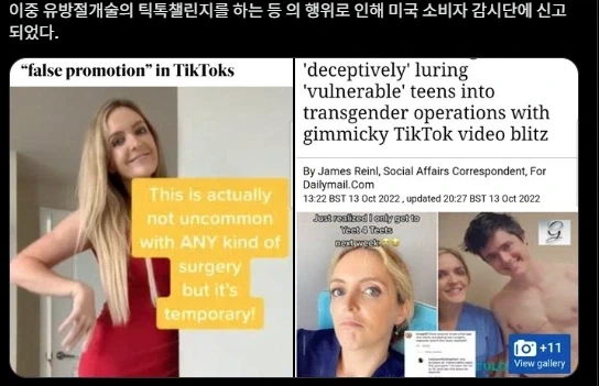 서양 여의사의 저세상페티시_2.webp