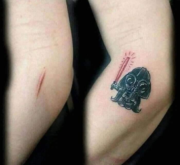 흉터를