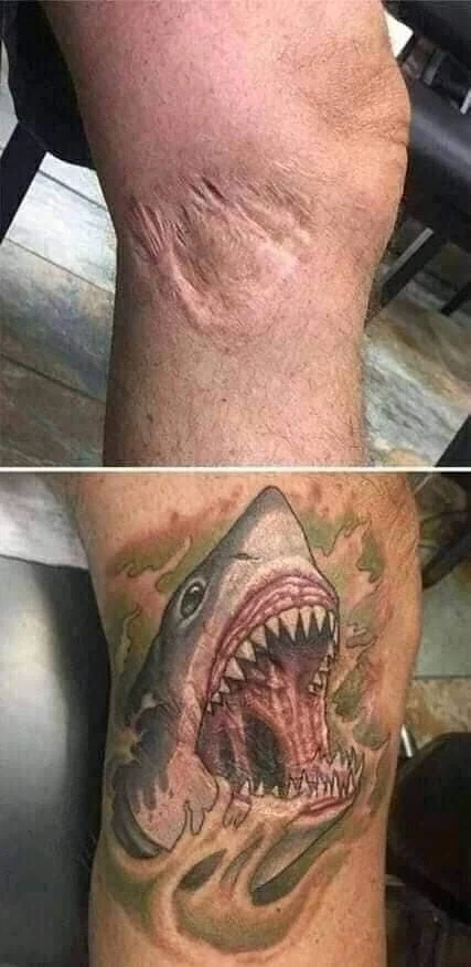 흉터를