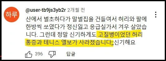 충격적인 말벌에 쏘인 후기_3.webp