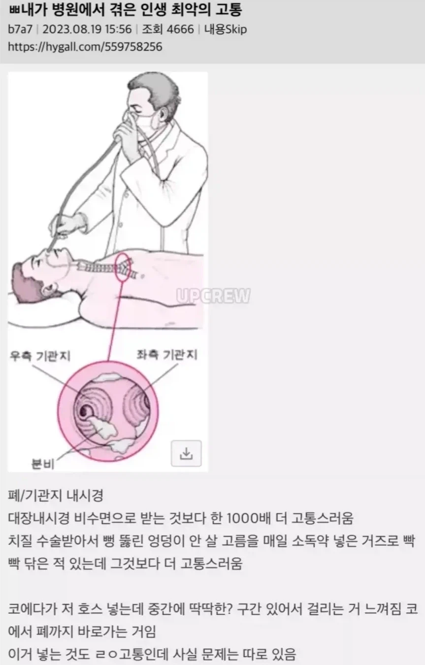 병원에서 겪은 인생 최악의 고통 TOP 1.jpg_1.webp