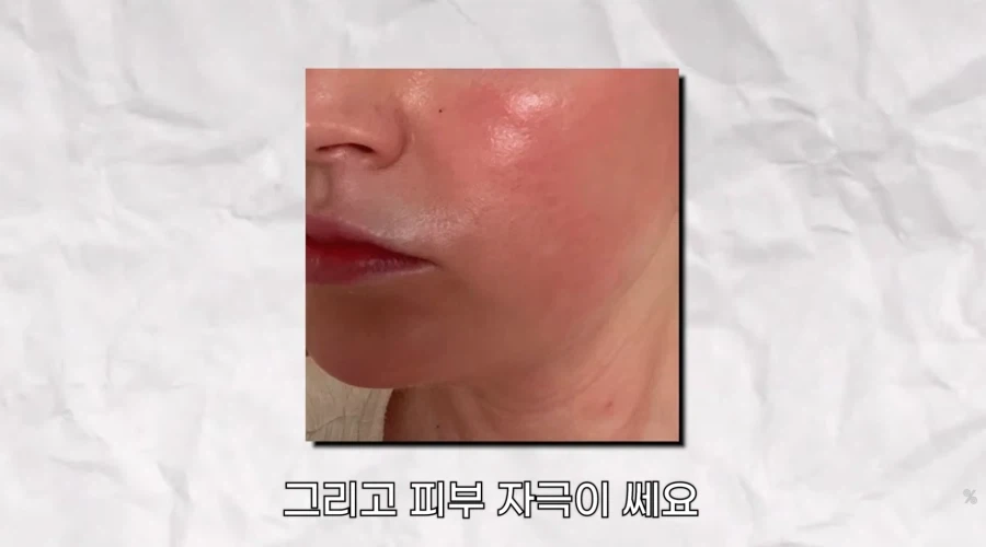 피부 하얘지는 방법_14.webp