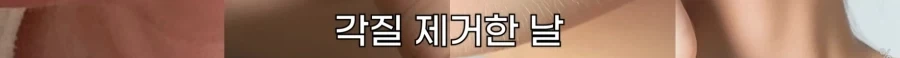 피부 하얘지는 방법_25.webp