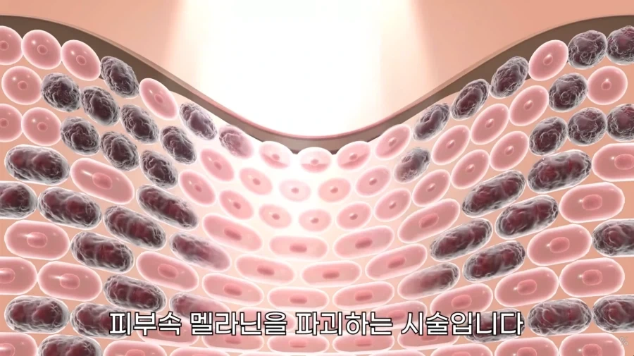 피부 하얘지는 방법_45.webp