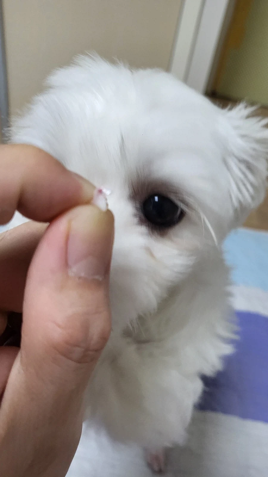 이게 환자분 이빨입니다_1.webp
