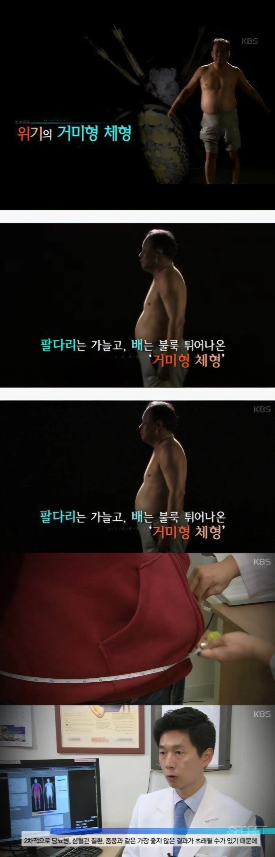 의사가 말하는 위험한 체형.jpg_1.jpg