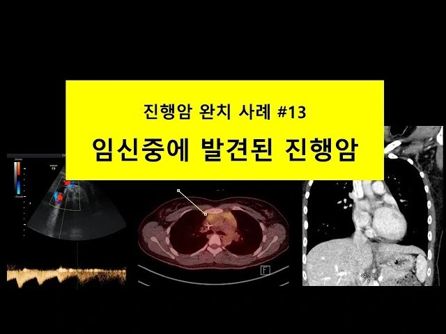 약혐) 현대 의학 기술의 한계_1.jpg