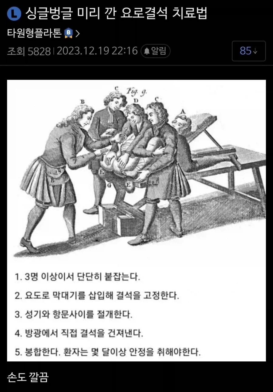과거의 요로결석 치료법.jpg_1.webp