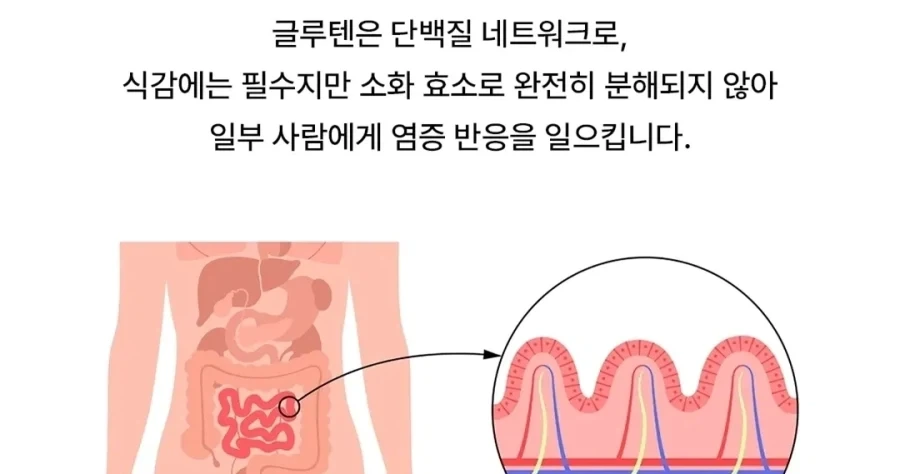 밥보다 면이나 빵이 소화가 잘 안되는 이유.eu_2.webp