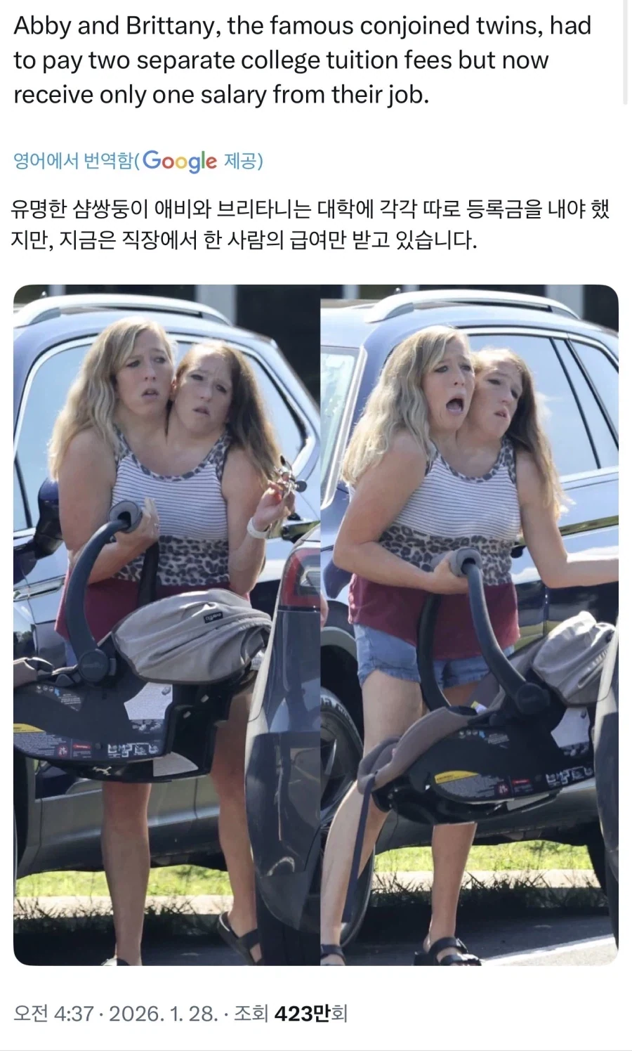 한 샴쌍둥이 자매의 존나게 불공평한 인생.jpg_1.webp