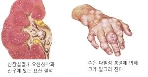 혐)물 많이 안마시면 생기는 단점이 머냐고?_1.webp