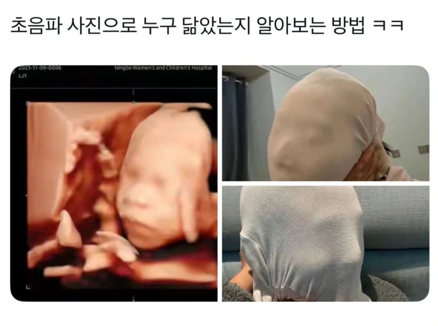 초음파사진으로 누구 닮았는지 알아보는법_1.webp