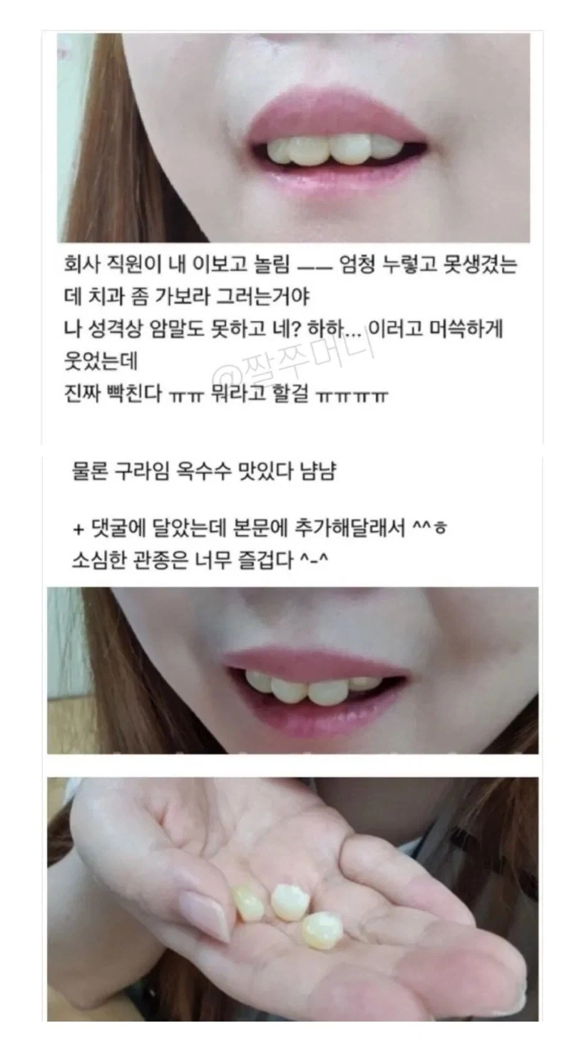 이빨을 강냉이라고 하는 이유._1.webp