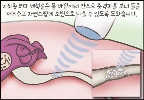 물을 자주 잘 마셔야하는 이유_1.webp