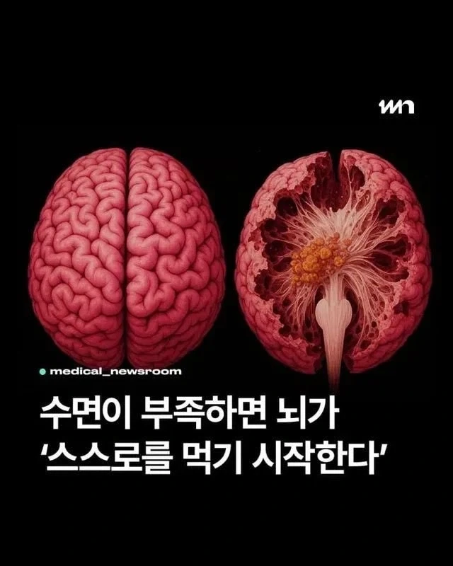 그걸 왜 쳐먹느냔 말이다아아아아앗_1.webp