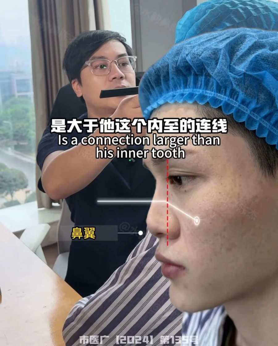 image.png SNS에서 뽑은 남자 코 성형 레전드 비포에프터.jpg