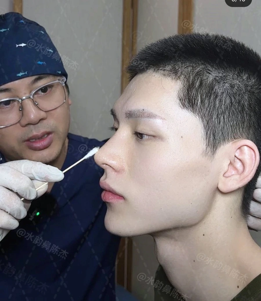 image.png SNS에서 뽑은 남자 코 성형 레전드 비포에프터.jpg