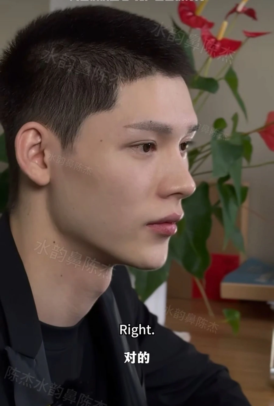 image.png SNS에서 뽑은 남자 코 성형 레전드 비포에프터.jpg