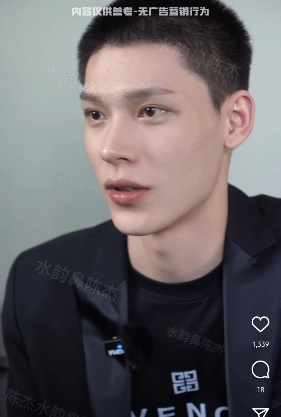image.png SNS에서 뽑은 남자 코 성형 레전드 비포에프터.jpg