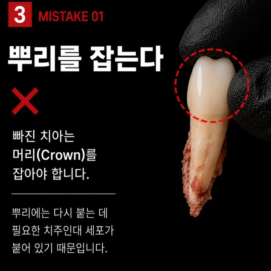 치아가 빠졌을때 절대 하면 안 되는 행동.jpg_3.webp
